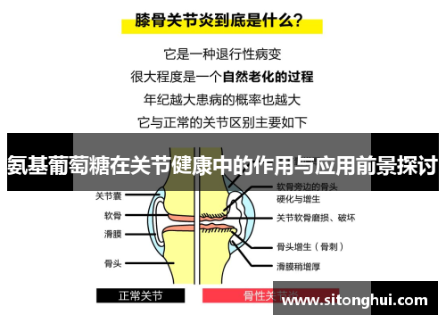 氨基葡萄糖在关节健康中的作用与应用前景探讨